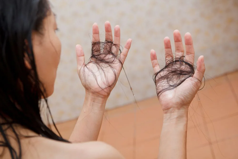 deficiência de ferro, que causa anemia, é uma das principais causas de queda de cabelo.