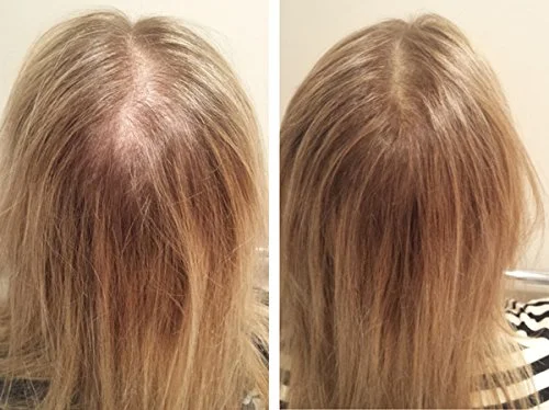 vitamina para cabelo